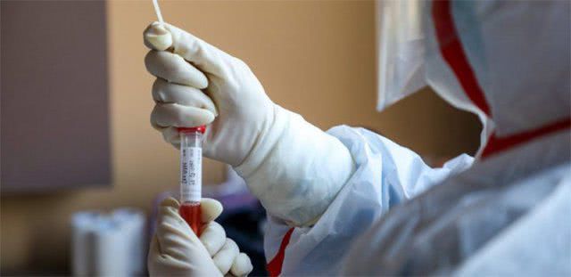 Херсонщина получила первые тесты для диагностики коронавируса