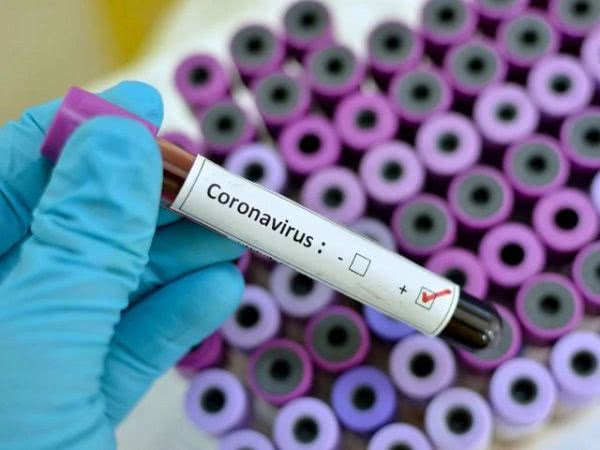 Случай заболевания COVID-19 в Херсоне не подтвердился, - мэрия