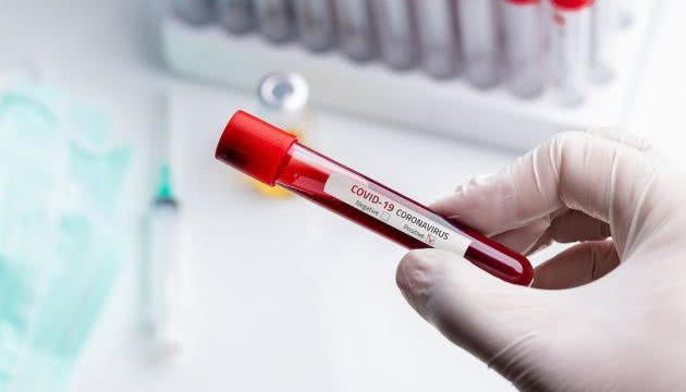 В Украине подтверждено 5 710 случаев COVID-19