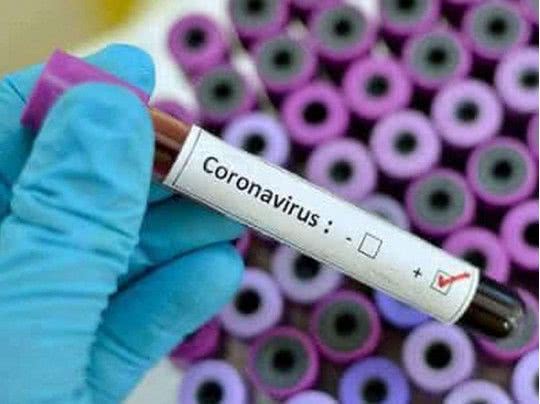 В Николаевской области зафиксировали первую смерть от коронавируса