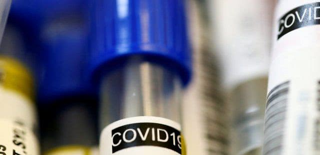 В Солонцах сегодня выявили 7 случаев заражения COVID-19 - Дмитрий Воронов