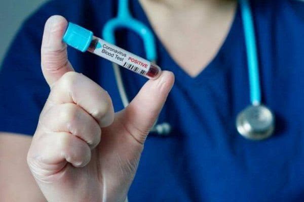 Сегодня зафиксированы 4 новые случаи COVID-19. Все - в Херсоне, - депутат