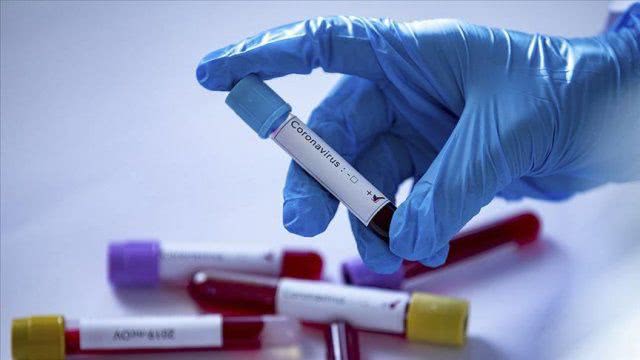 В Каховке за сутки выявлено 5 новых случаев инфицирования Covid-19