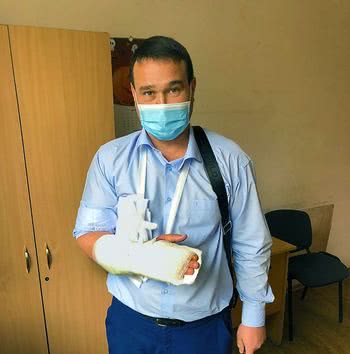 Паливода своему заместителю сломал руку. Часть первая