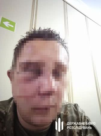 Побив та змусив витирати кров з взуття — на Херсонщині судитимуть військовослужбовця