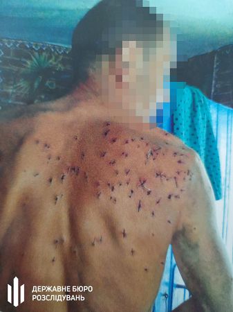 На Херсонщине будут судить лесника, который умышленно выстрелил из ружья в мужчину