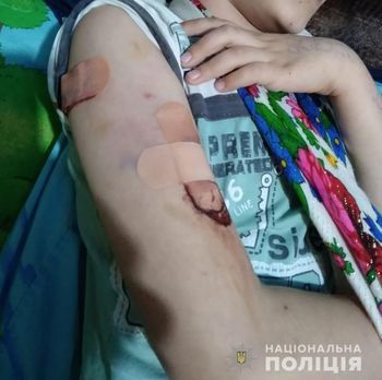 На Херсонщині поліцейському довелося застосувати табельну зброю, щоб врятувати від агресивних тварин трьох дітей
