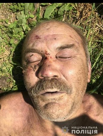Полиция Херсонщины устанавливает личность умершего мужчины