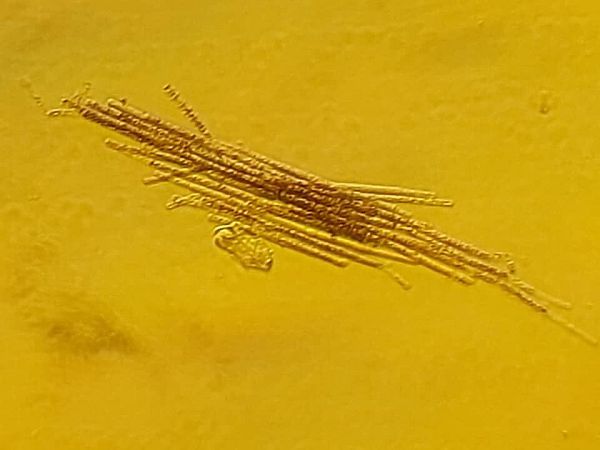 В Одессе позеленело море.