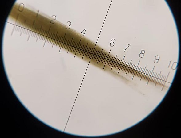 Колонии афанизоменона под микроскопом.