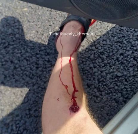 Херсон стрельба ранения