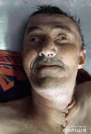В Херсоне полиция устанавливает личность умершего мужчины