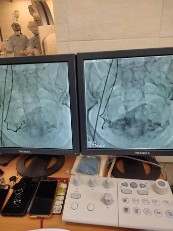 В обласній лікарні Херсонщини було проведено перші 3 операції на серці та головному мозку