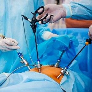 У Бериславській районній лікарні хірурги роблять лапароскопічні операції