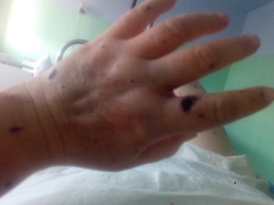 Жителька Високопілля після обстрілів: «Лихо постукало в стіни мого будинку» Жителька Високопілля після обстрілів: «Лихо постукало в стіни мого будинку»