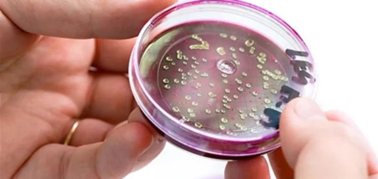 Окупанти знову повідомляють про кишкову паличку в Голій Пристані