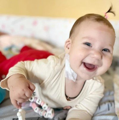 Львівські лікарі прооперували маленьку дівчинку з Берислава