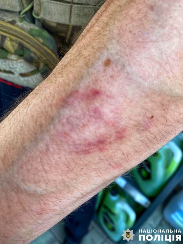 У Херсоні перешкоджаючи поліцейським перевірити документи свого 23-річного сина, жінка вкусила поліцейського за руку