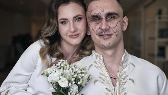 Жартували, що Михайло був майже “200". Кохання і повернення до життя важкопораненого бійця з Херсонщини